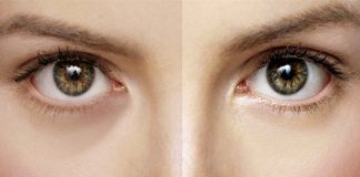 This one trick will help you remove dark circles fast