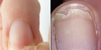 5 Amazing Tips For Fragile Nails